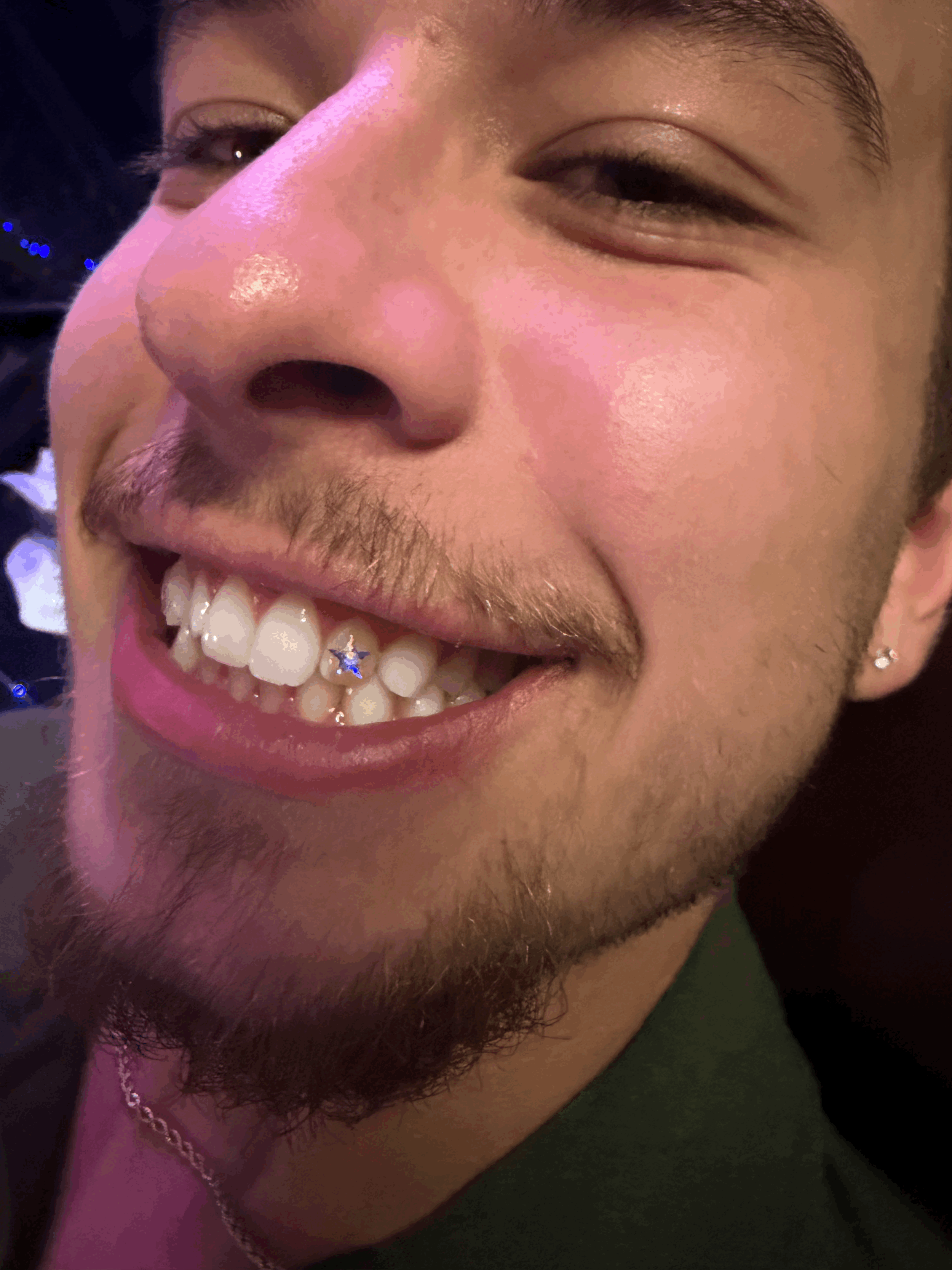 💎 Single Tooth Gem 💎