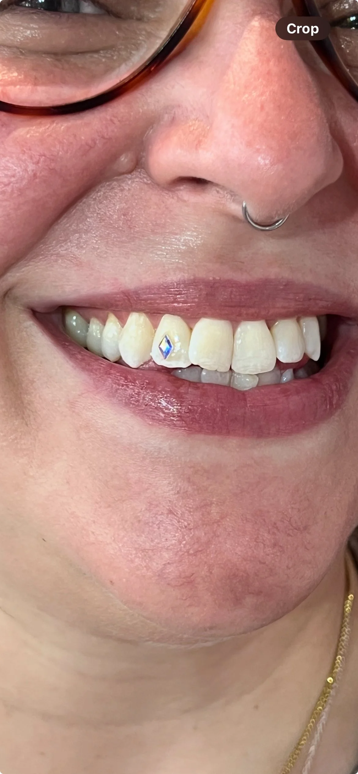 💎 Single Tooth Gem 💎