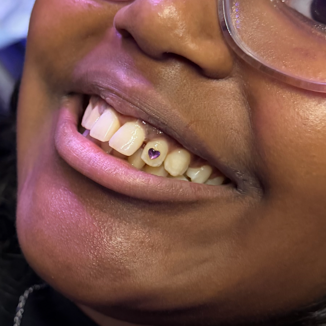 💎 Single Tooth Gem 💎