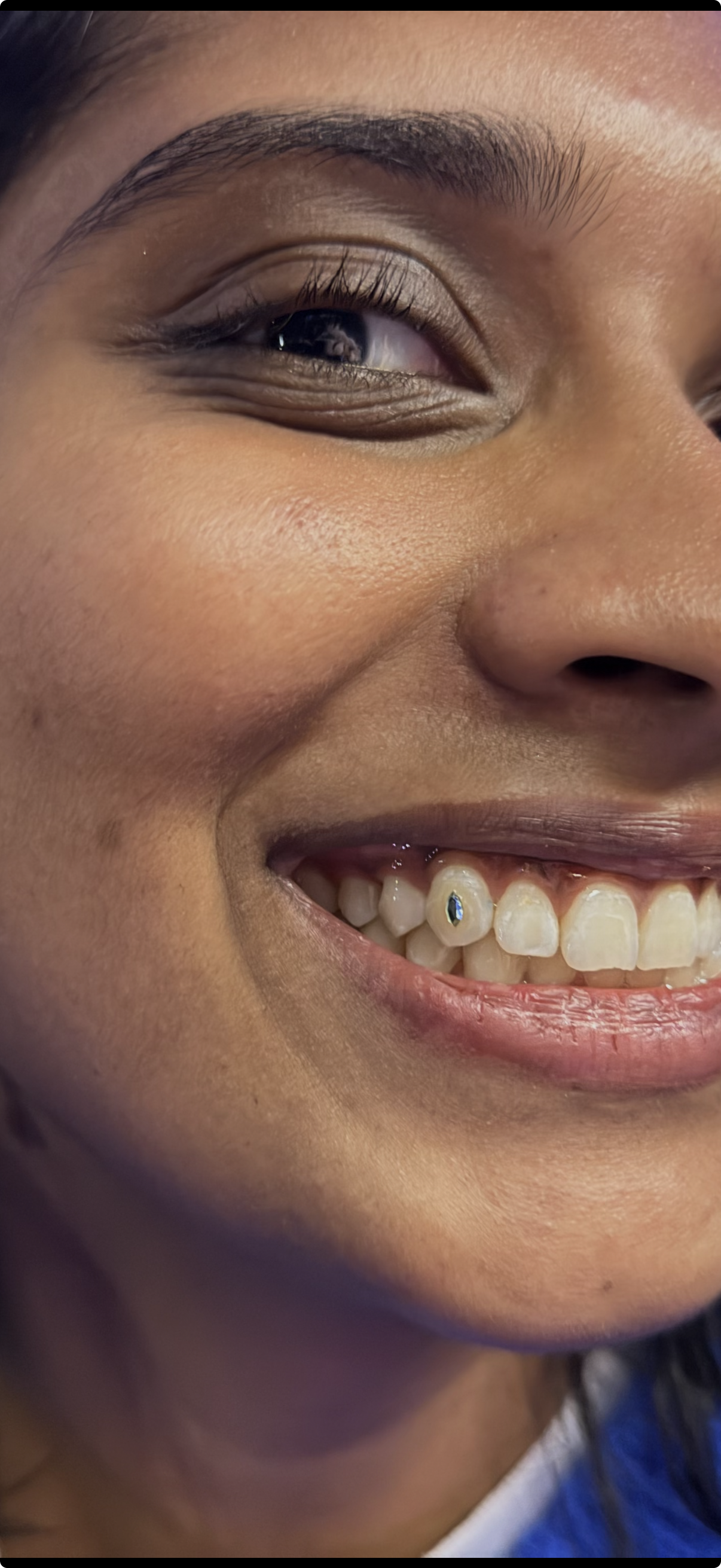 💎 Single Tooth Gem 💎