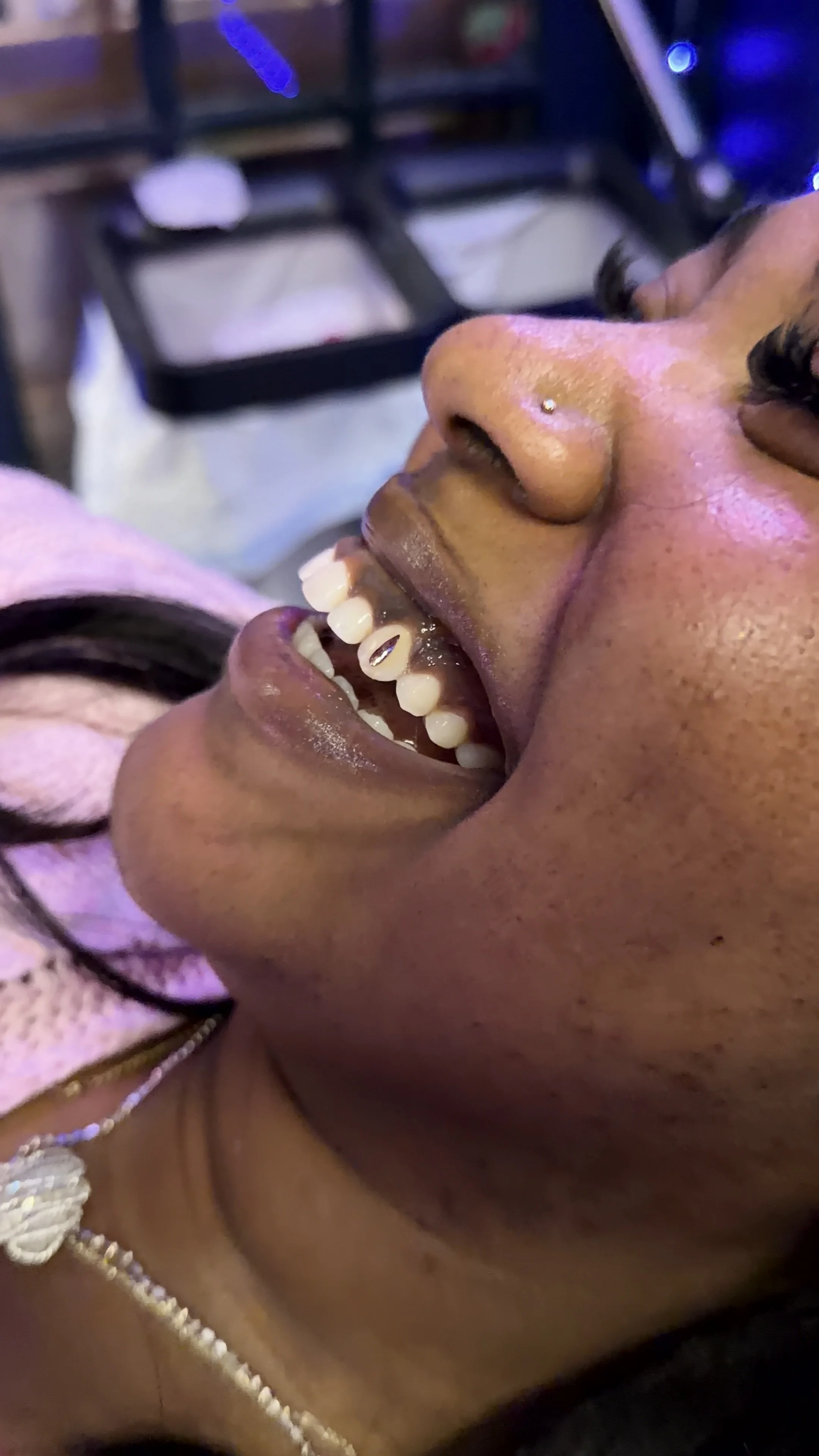 💎 Single Tooth Gem 💎