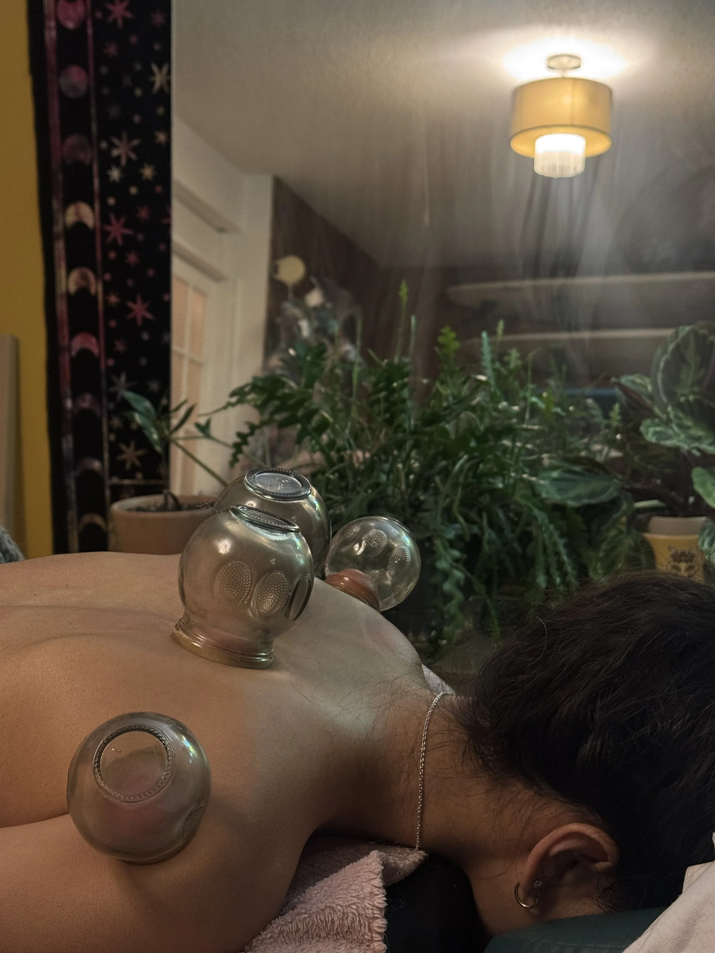 Cupping Therapy Benefits: 7 Powerful Reasons to Try It