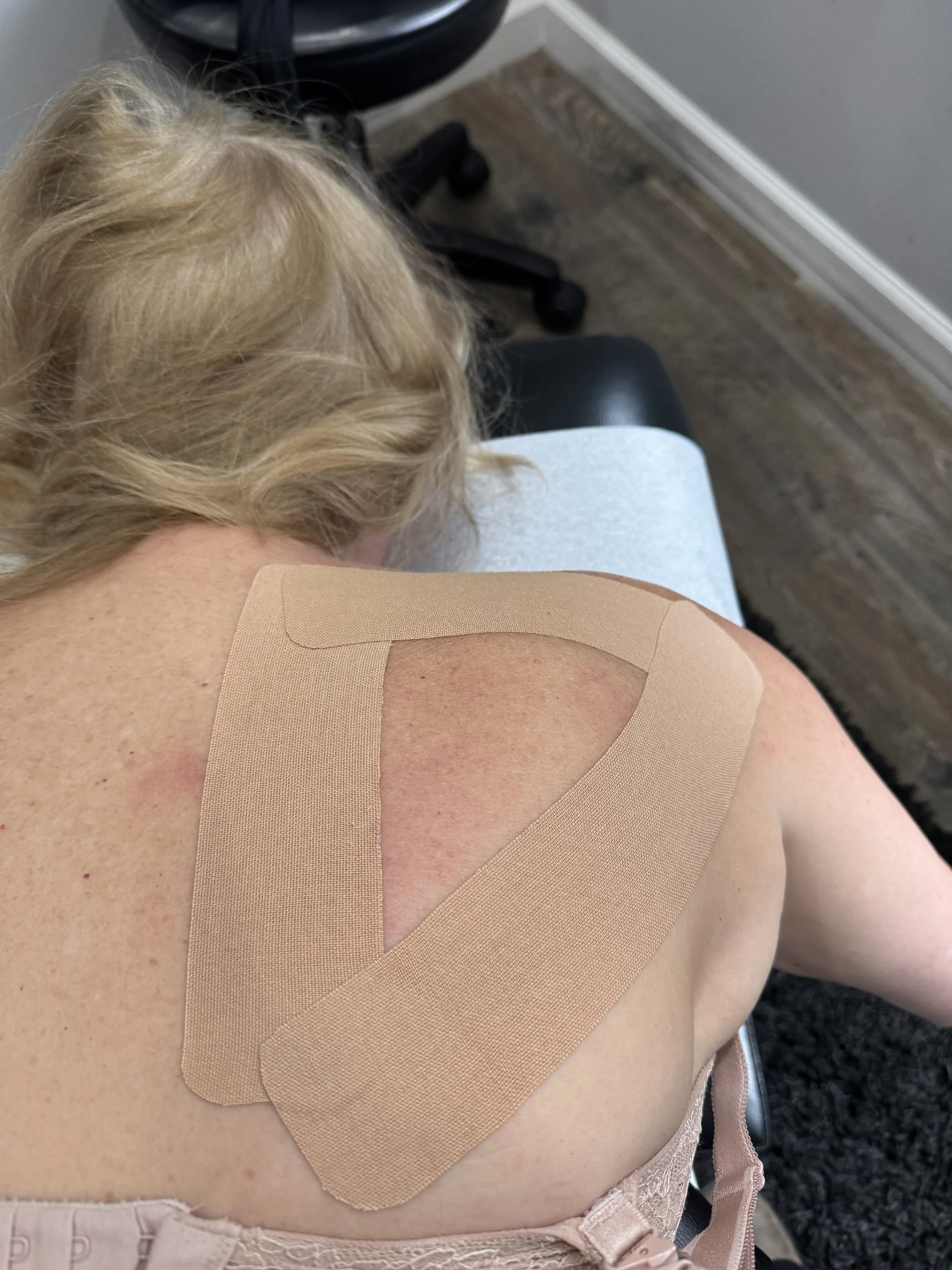 Acupuncture for Shoulder Pain: 7 Proven Benefits