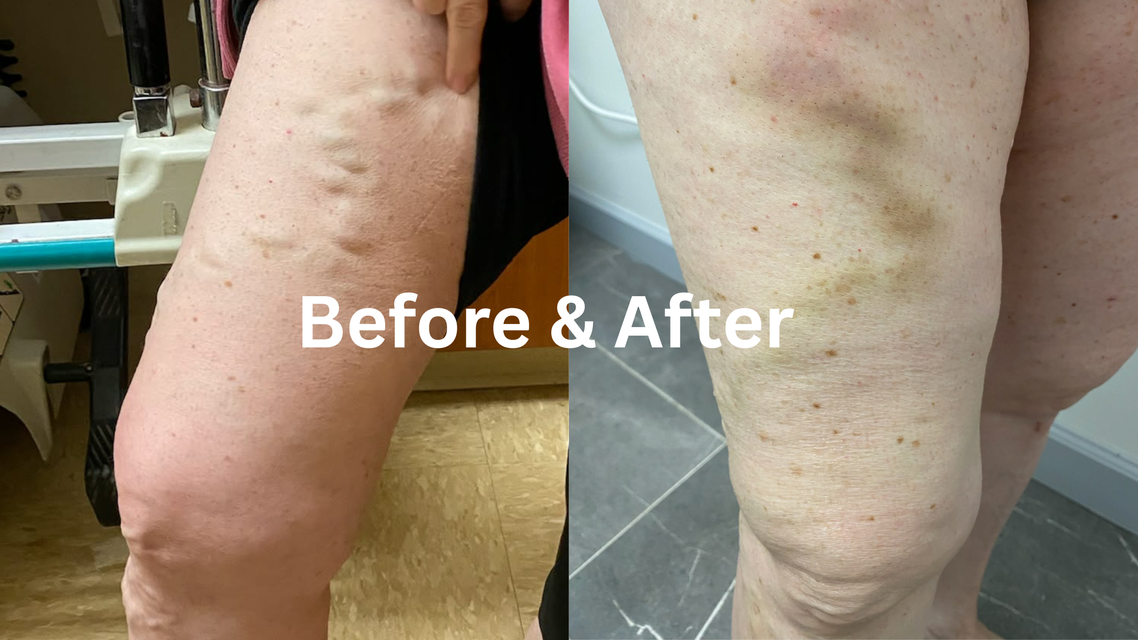 Compression Necessities