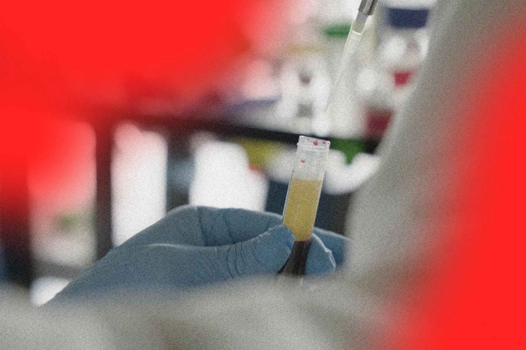 WHO AFRICA RELEASES GROUNDBREAKING GUIDANCE TO BOOST FIGHT AGAINST SICKLE CELL DISEASE