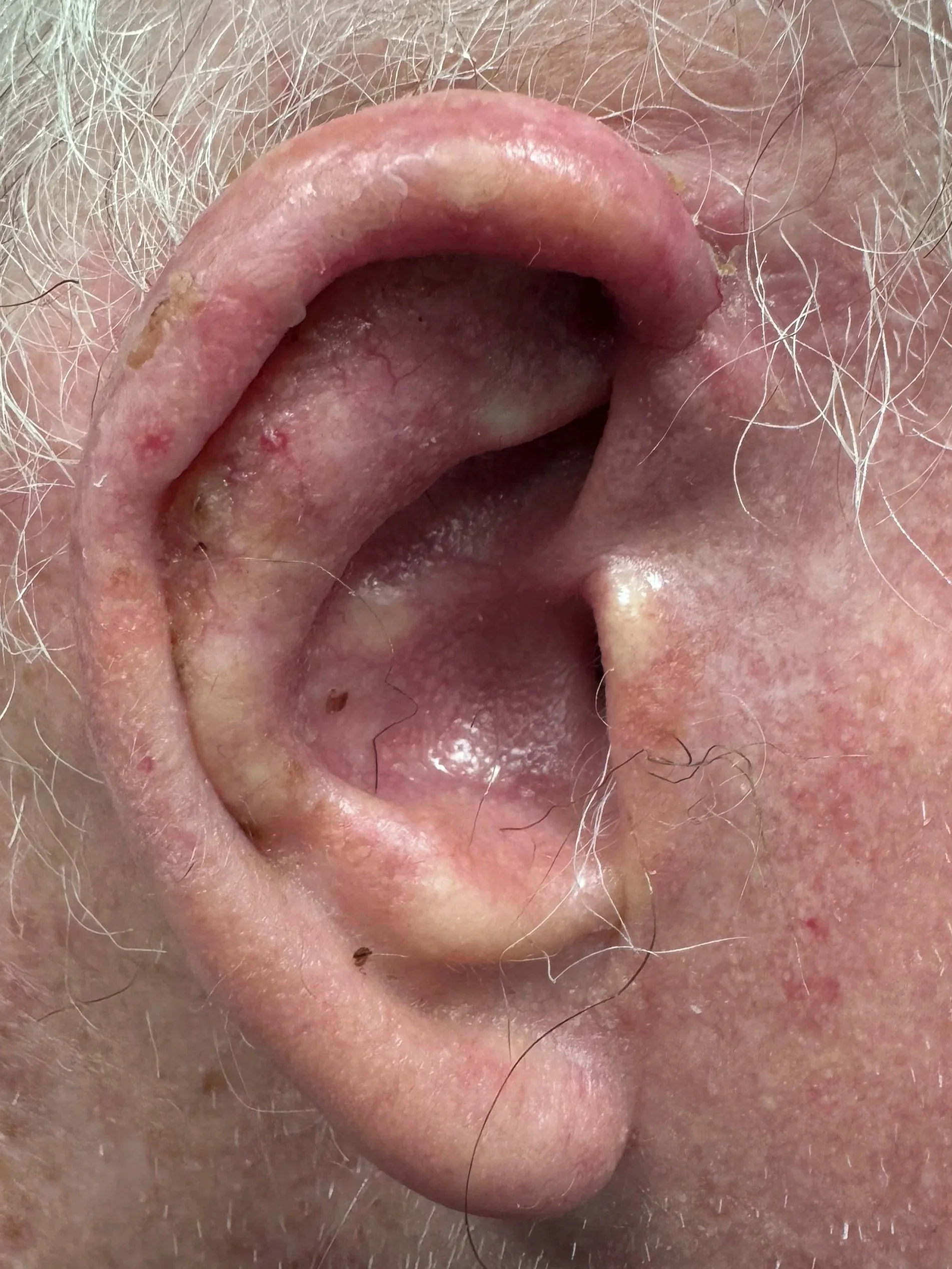 Appearance of ear at 7 weeks