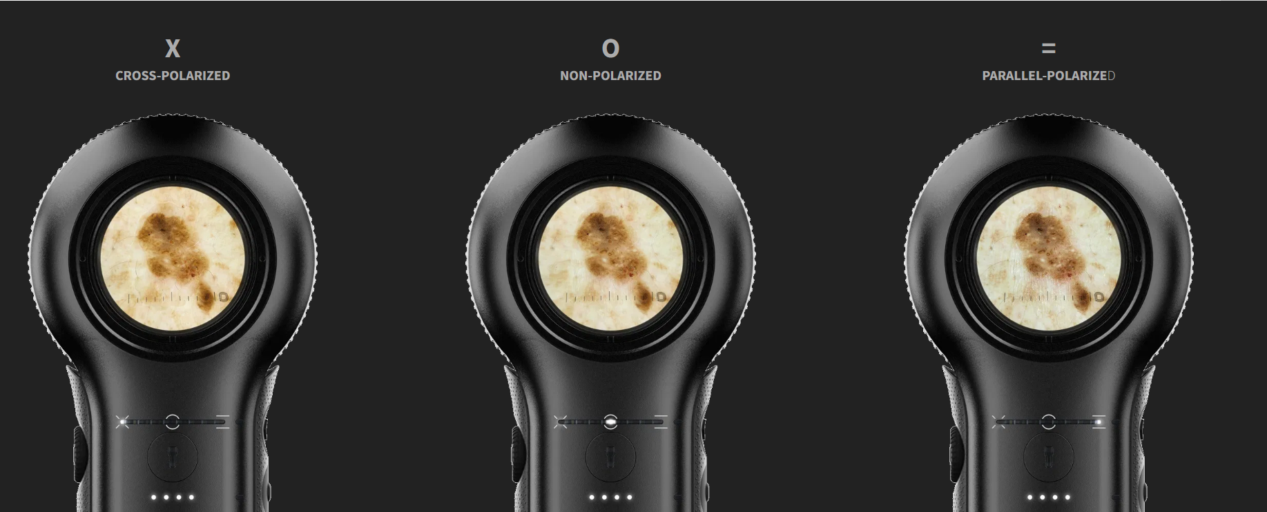 Comparison of three digital microscopes showing different polarization modes: cross-polarized, non-polarized, and parallel-polarized, each displaying a skin lesion.