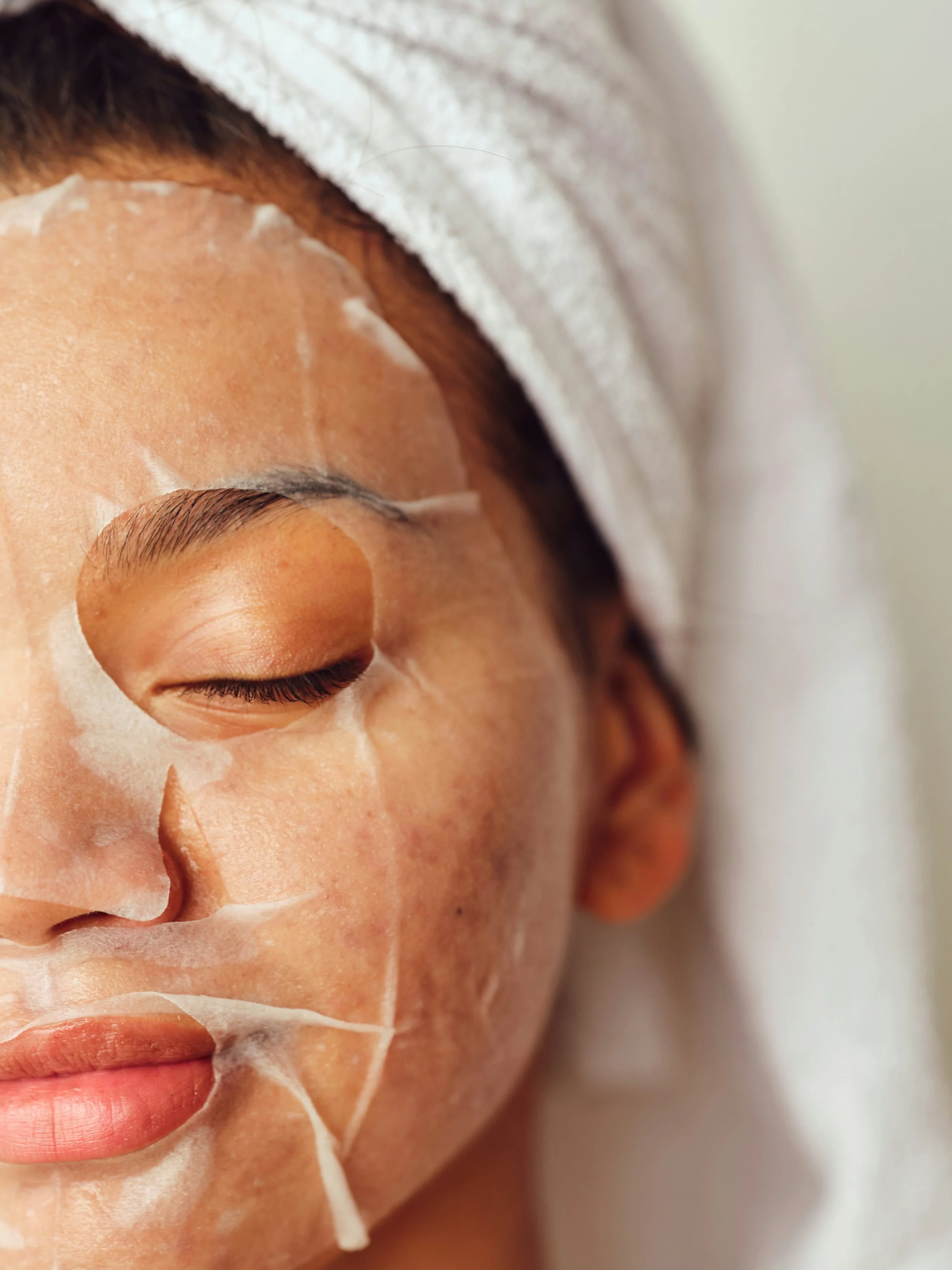 Acne! Getting to the root cause! 