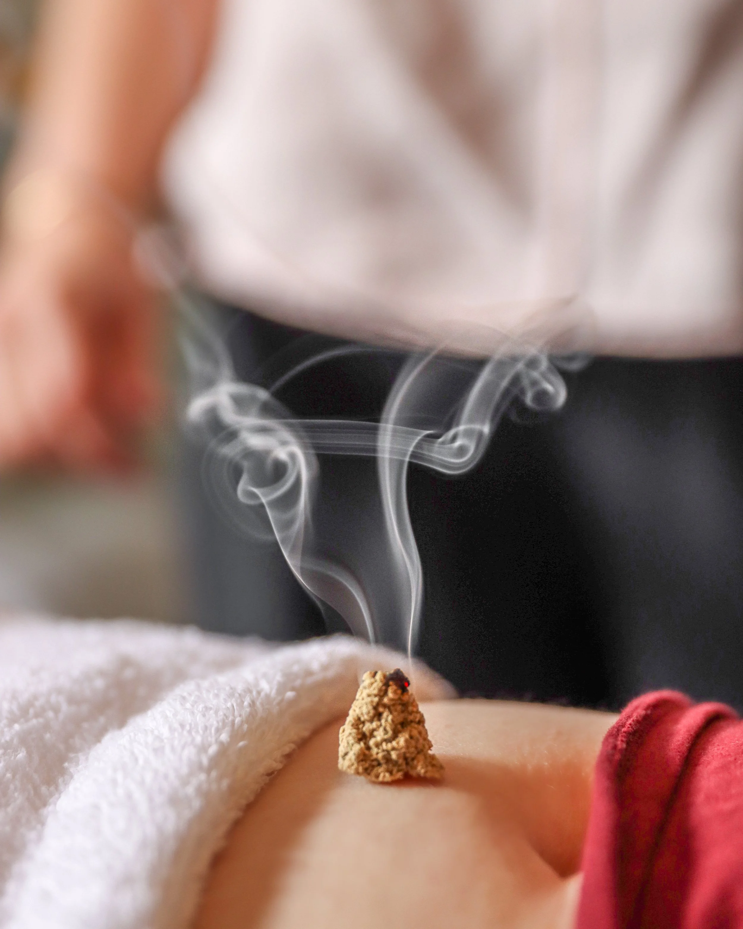 General Acupuncture