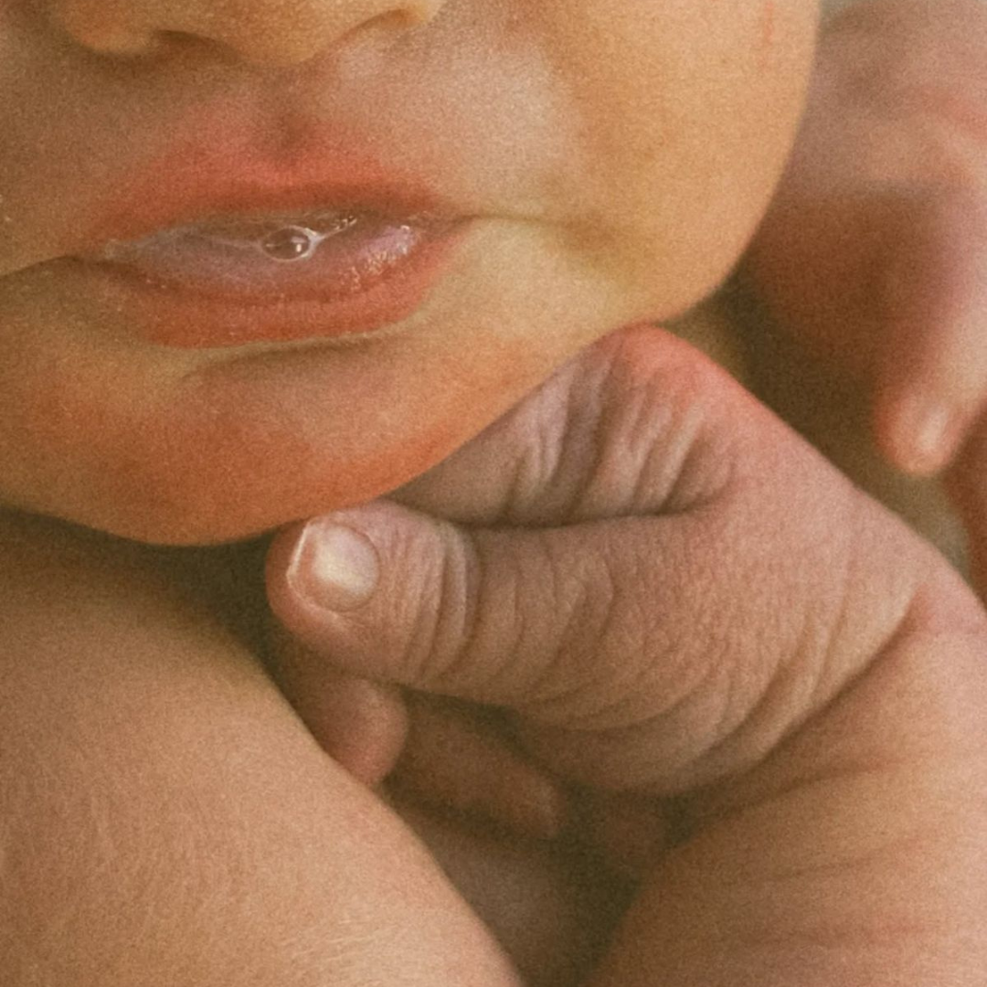 A Guide To: Eczema in Children