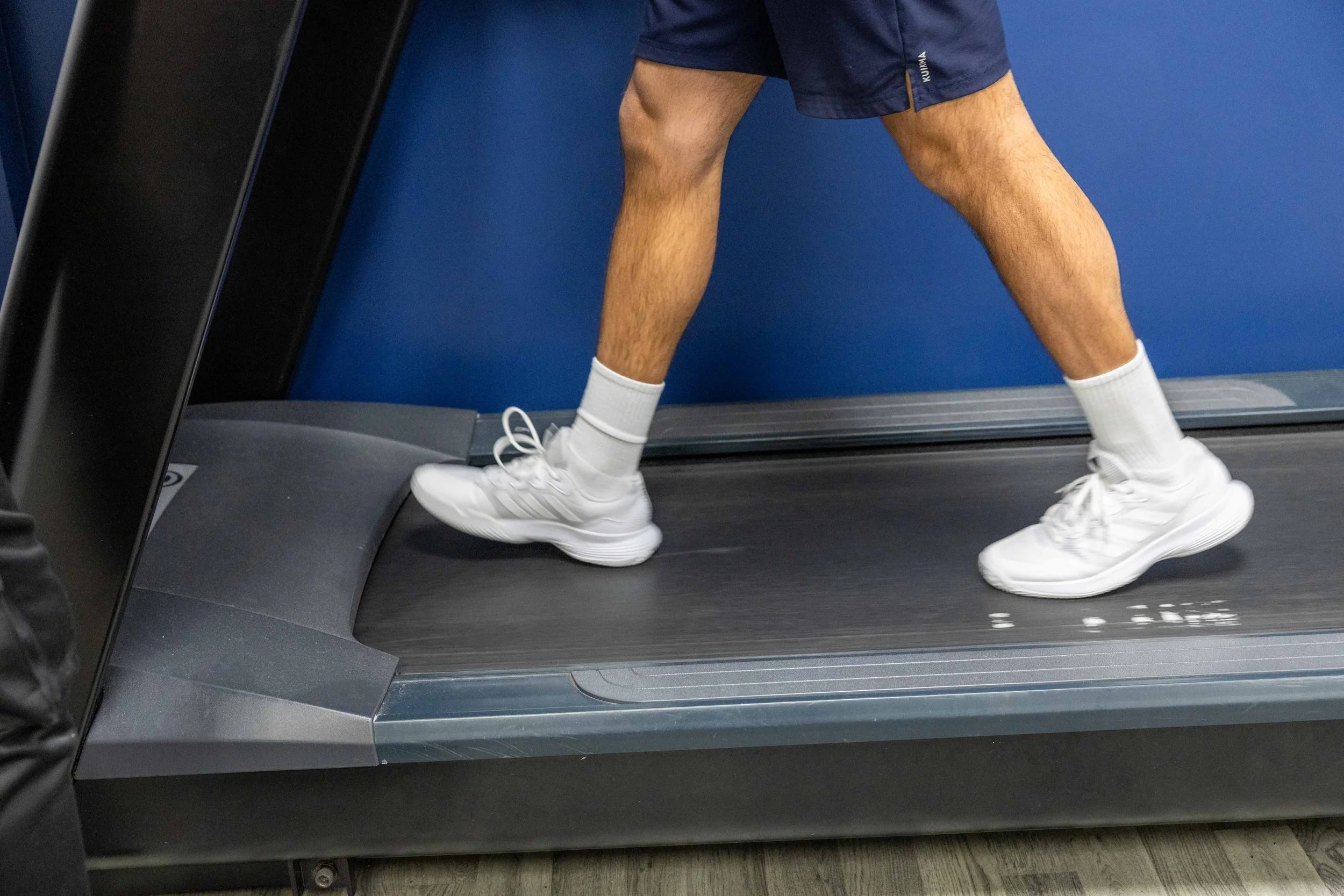 Shin Splints: What They Are and How to Treat Them