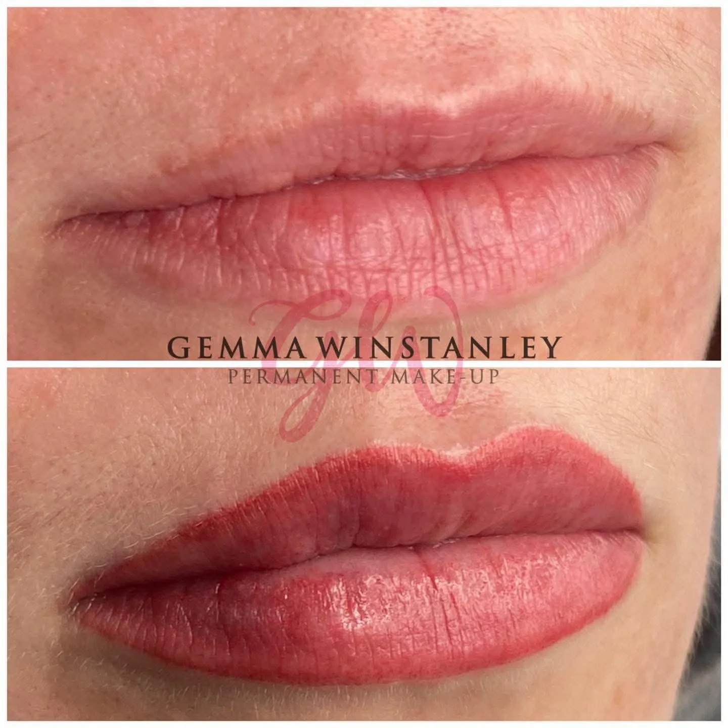 Before and after photos showing lips: the top image shows natural lips without makeup, and the bottom image shows lips with permanent pink lipstick applied