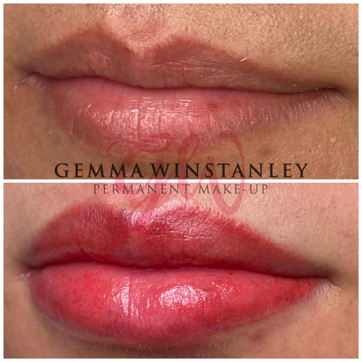 Close-up of a person's lips showing a before and after comparison of permanent lip makeup, with the before image at the top and the after image at the bottom, featuring enhanced lip color and definition.
