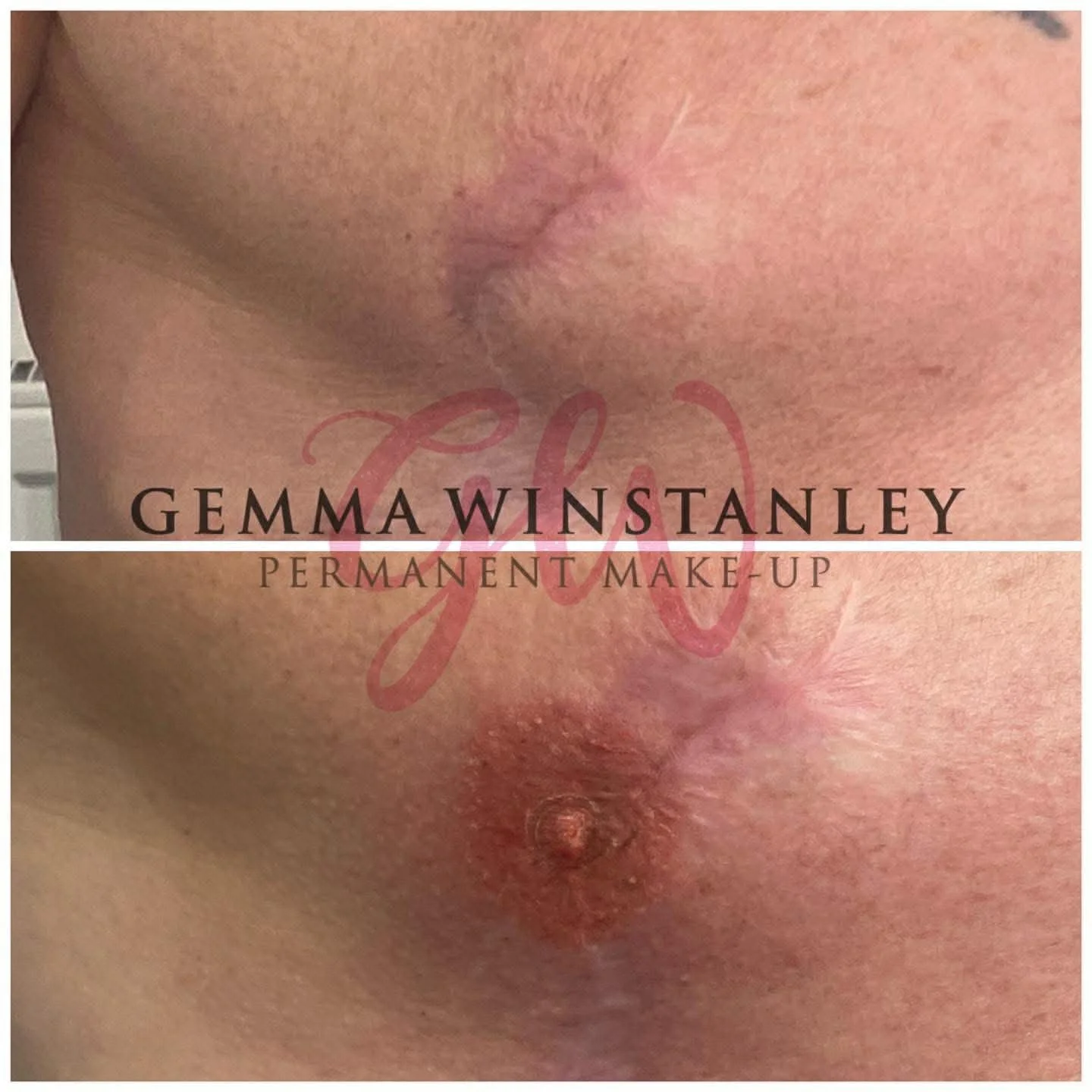 Close-up of a person's facial skin before and after permanent makeup, focusing on the eyebrow area. The bottom image shows the application of pigment on the eyebrow.