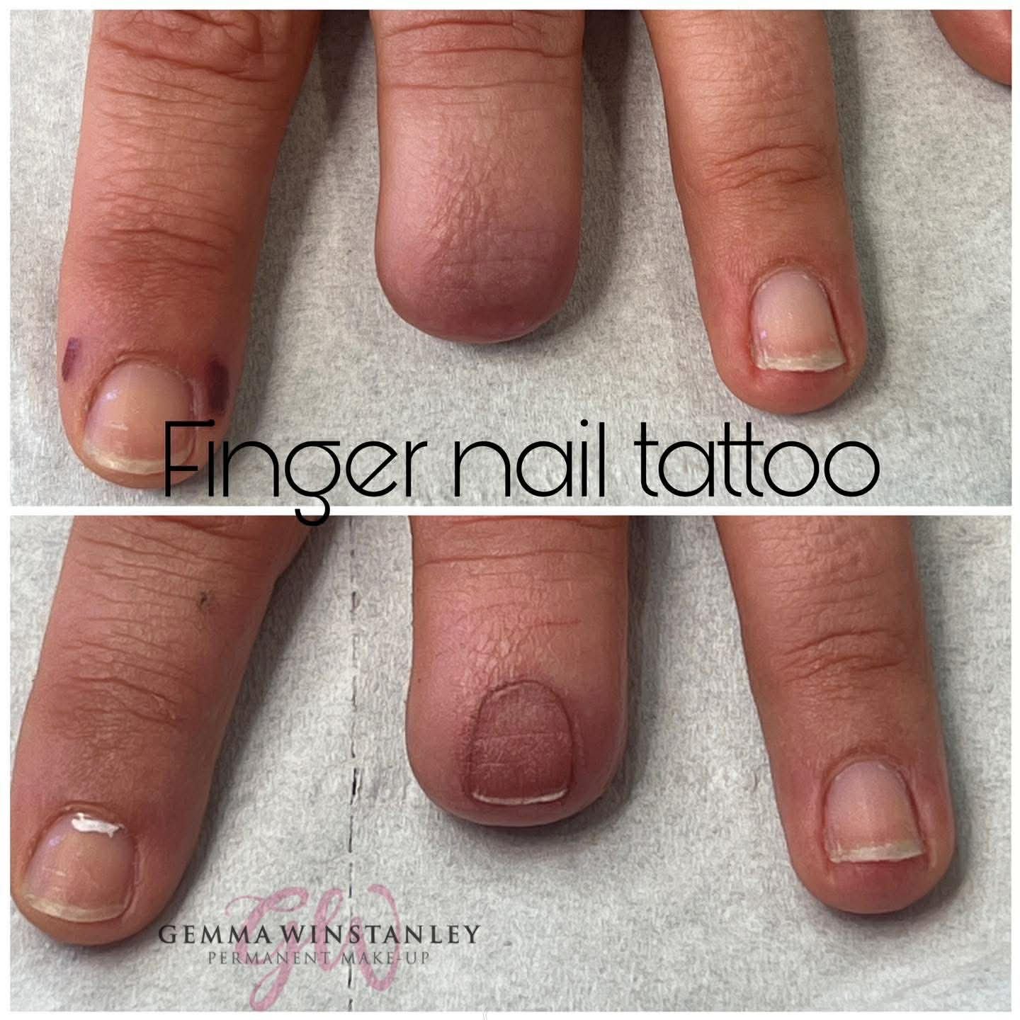 Close-up image of fingernails before and after finger nail tattoo procedure, showing the transformation of the nails from unpolished and stained to clean and tattooed.