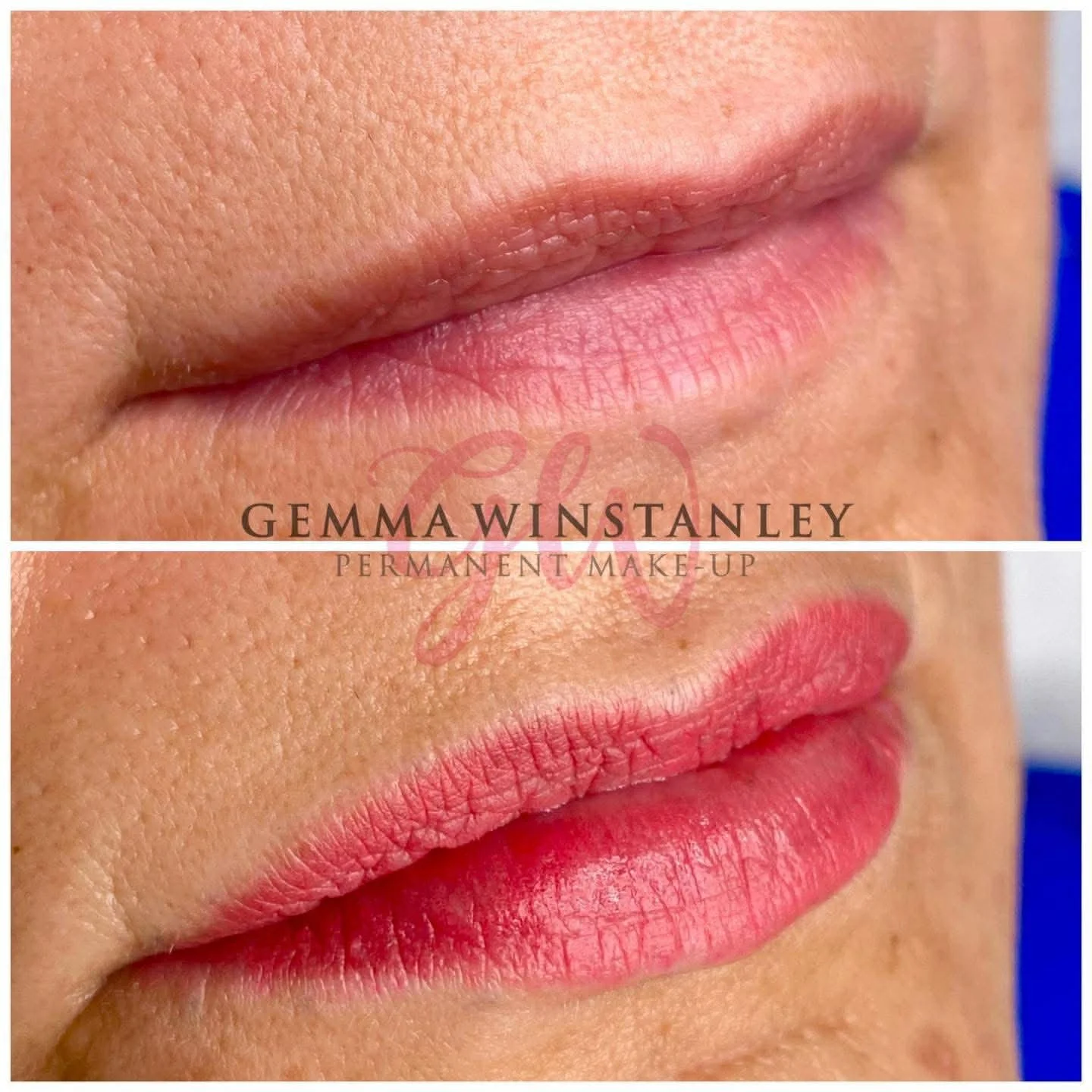 Close-up of a woman's lips before and after permanent makeup application, showing natural lip color in the top image and pink lipstick in the bottom image.