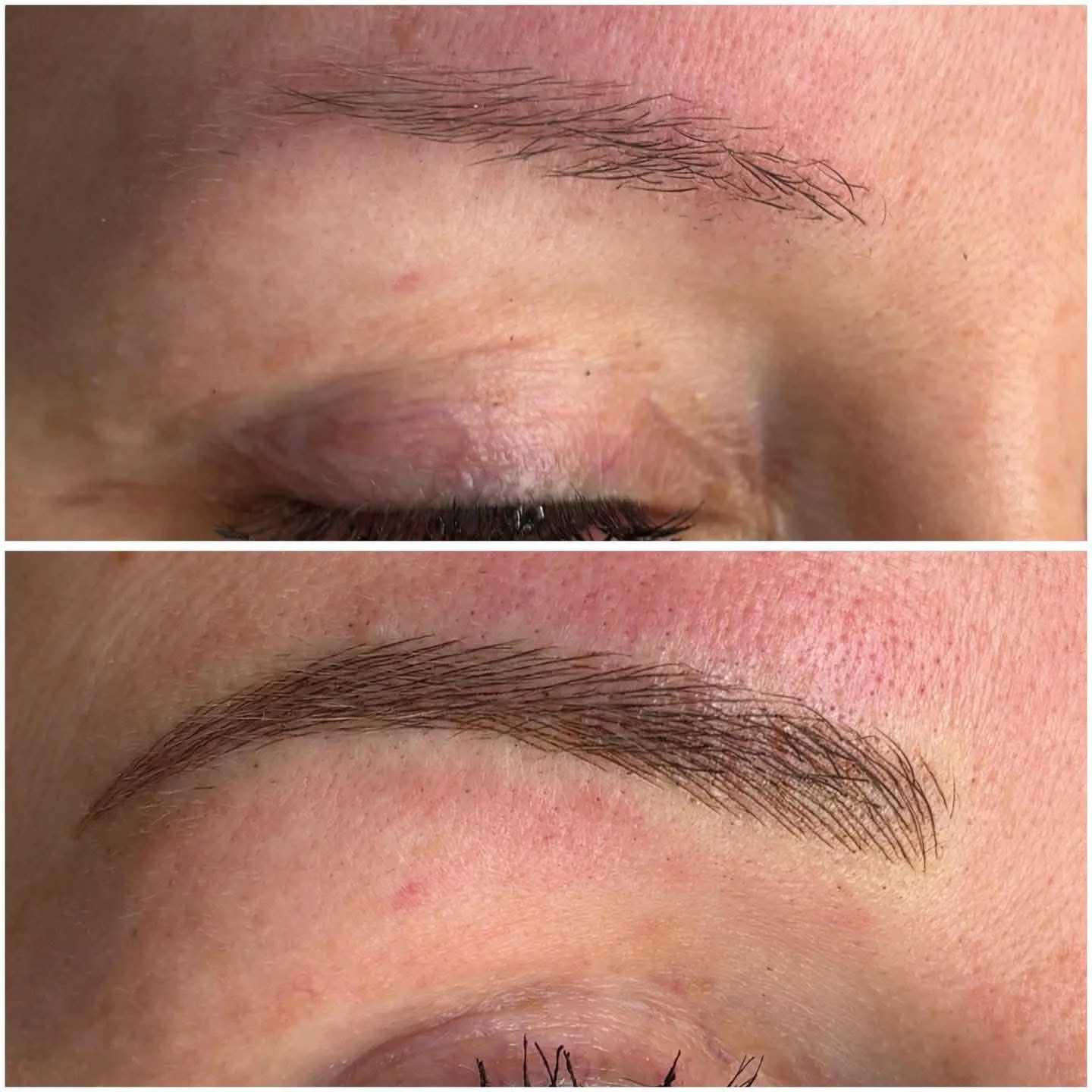 Before and after images of a person's eyebrow, showing the transformation from sparse to a fuller, well-shaped eyebrow.