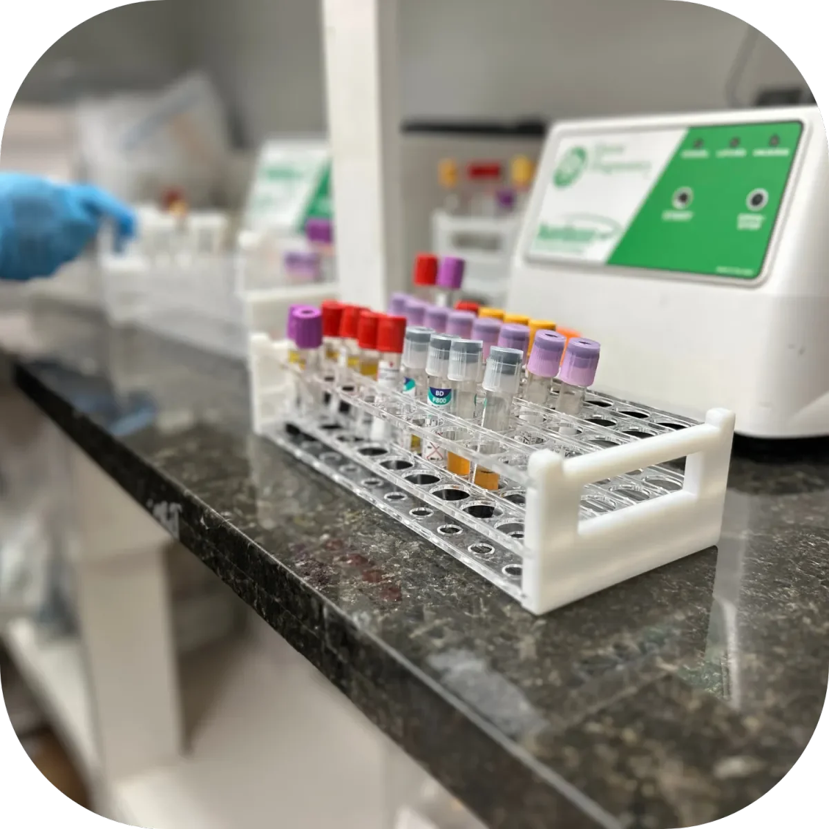 Muestras de muestras de sangre en tubos en un soporte en un laboratorio.