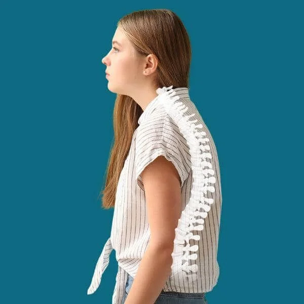 girl with forward head posture and a spine graphic on her body