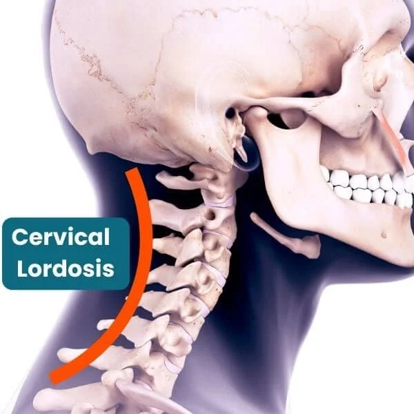 anatomu graphic of neck and cervical lordosis