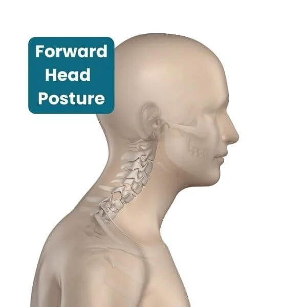 anatomy graphic of forward head posture we want to avoid in yoga