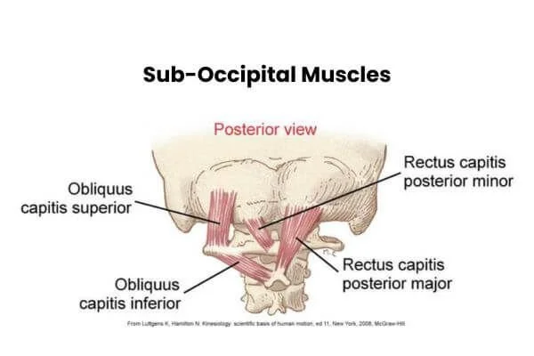 anatomy graphic of subocciptial muslces that ofen get overworked in locust posture