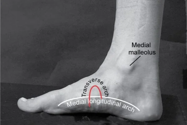 graphic image of the three arches of the foot that yoga can impact