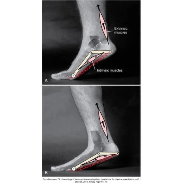 images of feet and arches explaining biomechanics