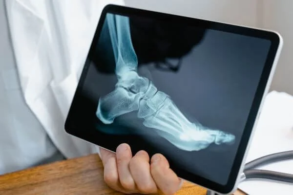 X-ray of foot look at shape of arches for yoga anatomy schoool