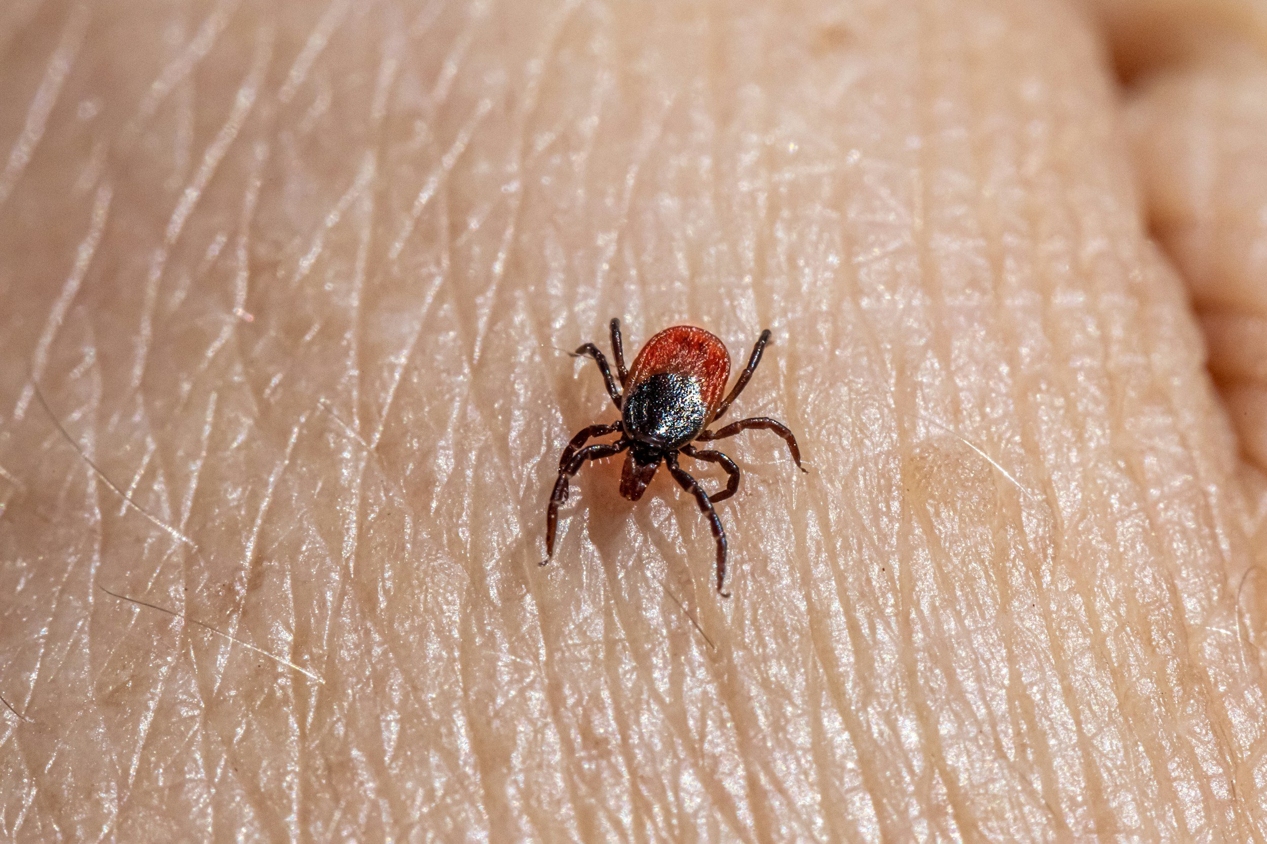 Close-up of a tiny tick on human skin.