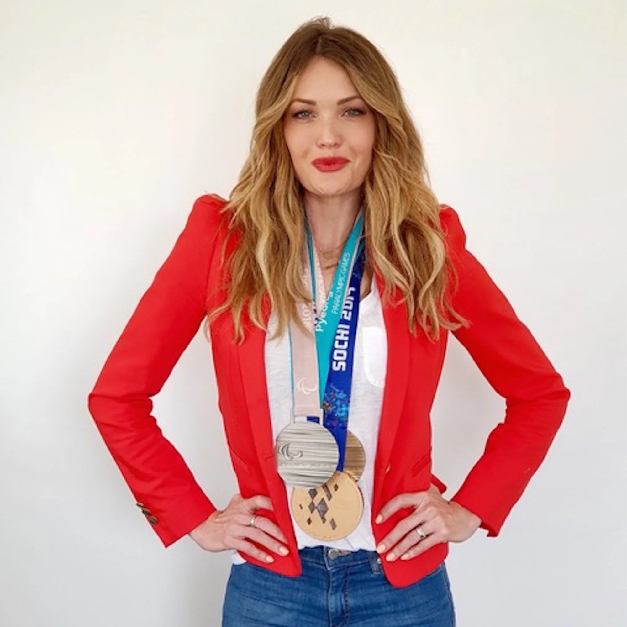 Amy Purdy
