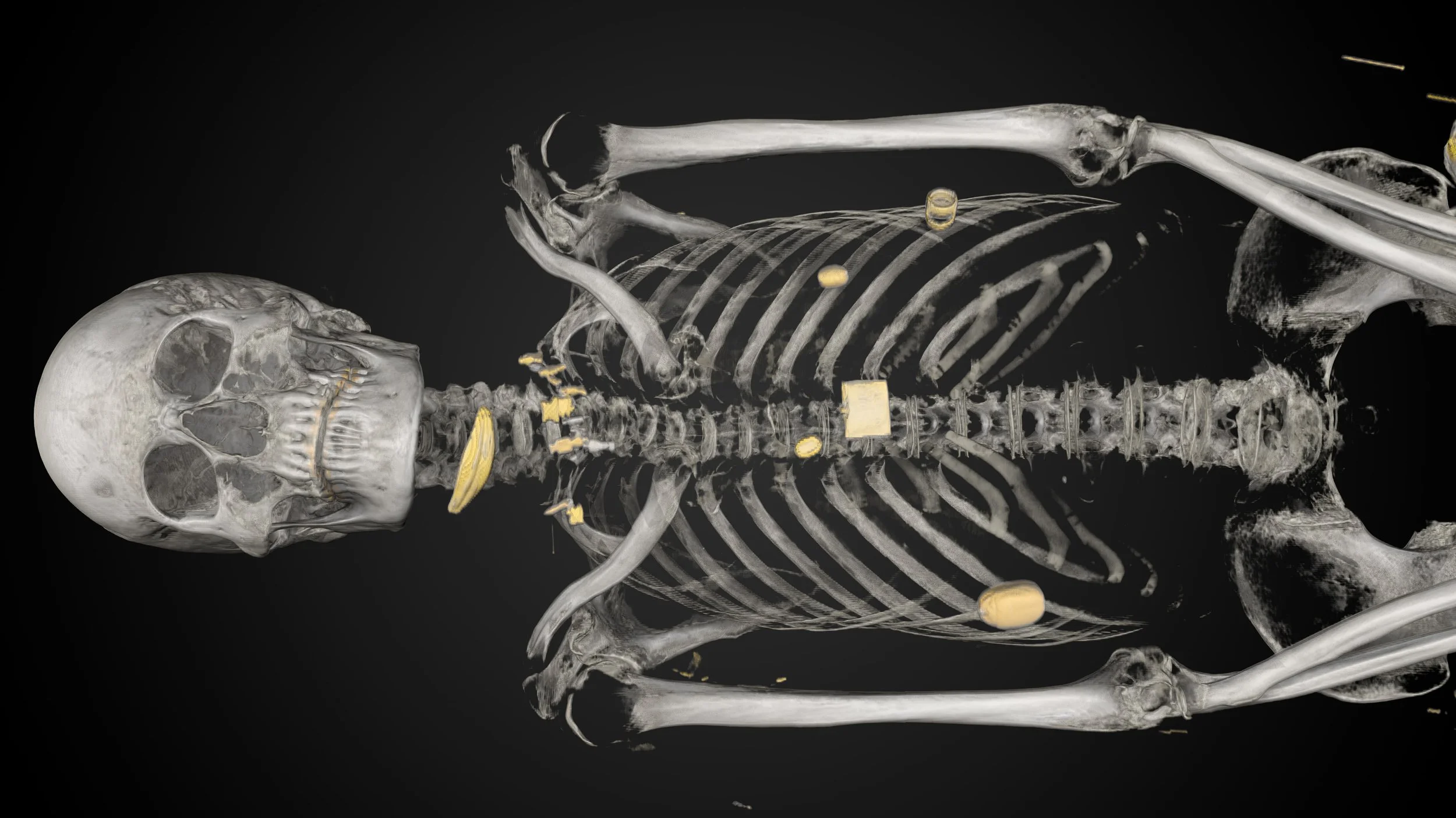 Ankhhor_mummy_©_Interspectral_04.jpg