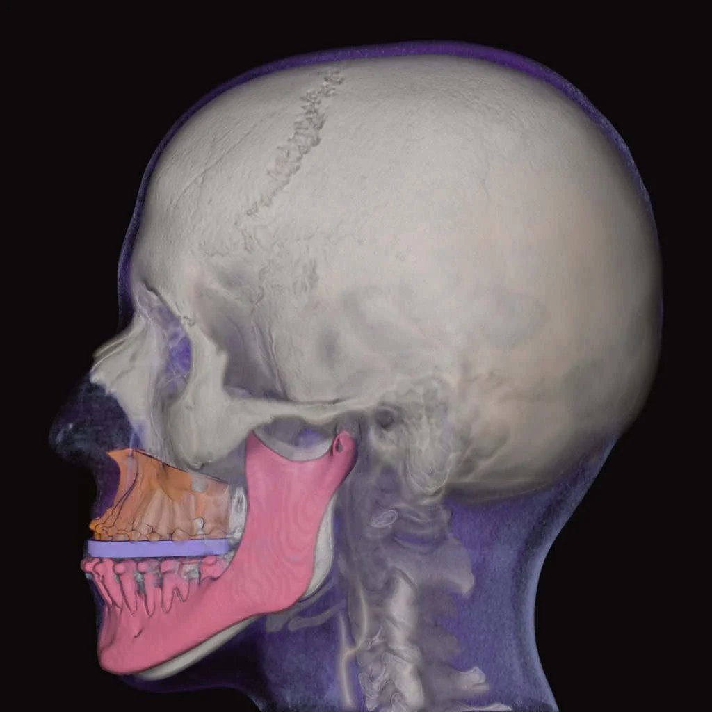 Human Anatomy Exhibit - 3D Printing and Implants