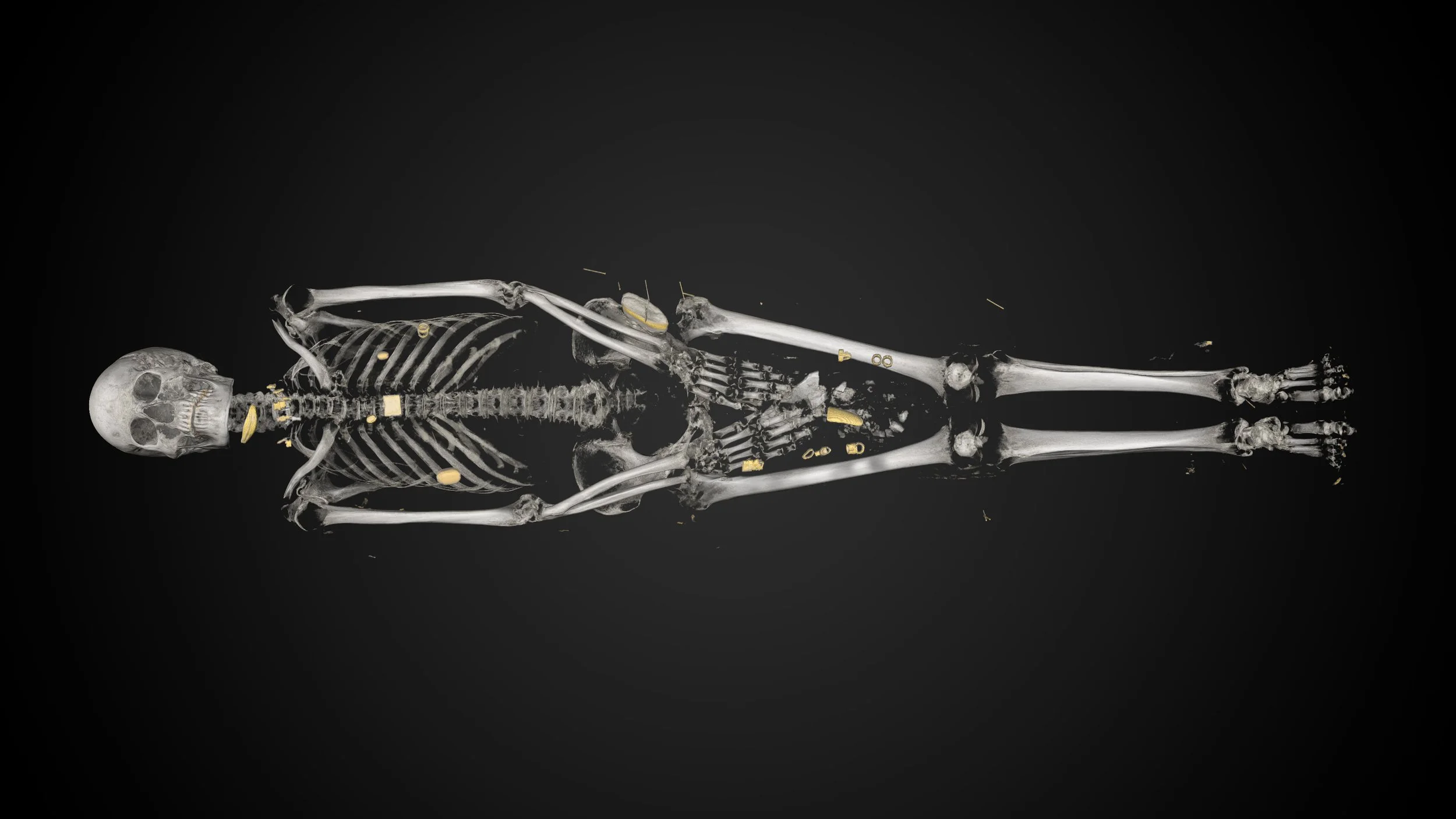 Ankhhor_mummy_©_Interspectral_02.jpg