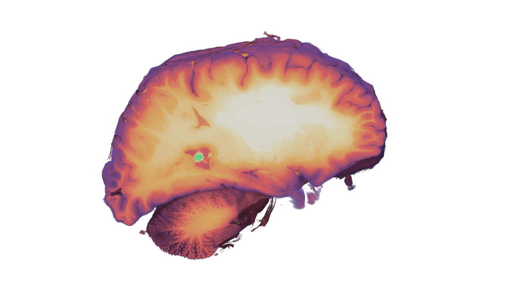 Brain.png