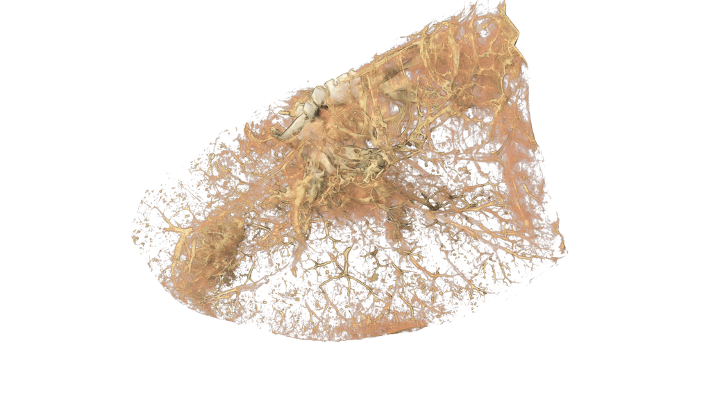 Lung.png