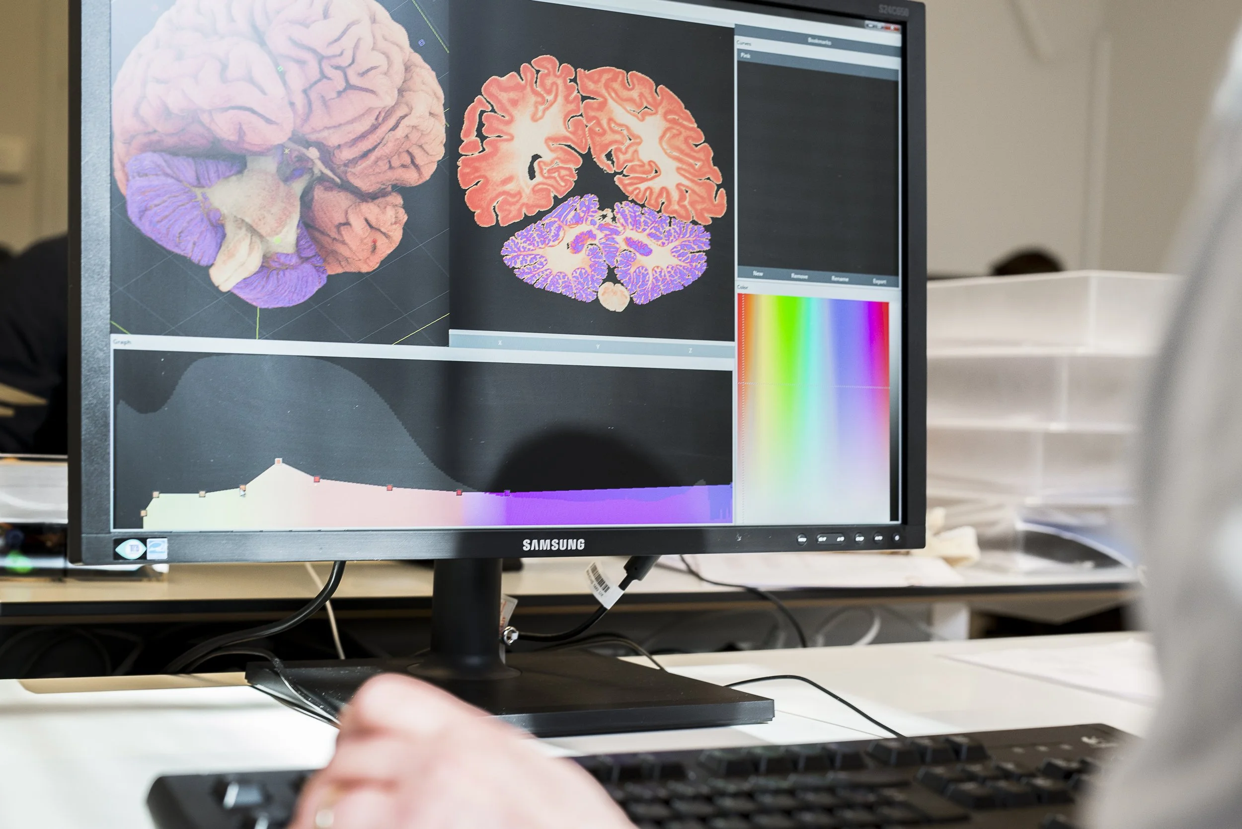 Computer monitor displaying images of a human brain in different color-coded representations. The images show detailed diagrams of brain anatomy, with color bars for reference, on a black background.