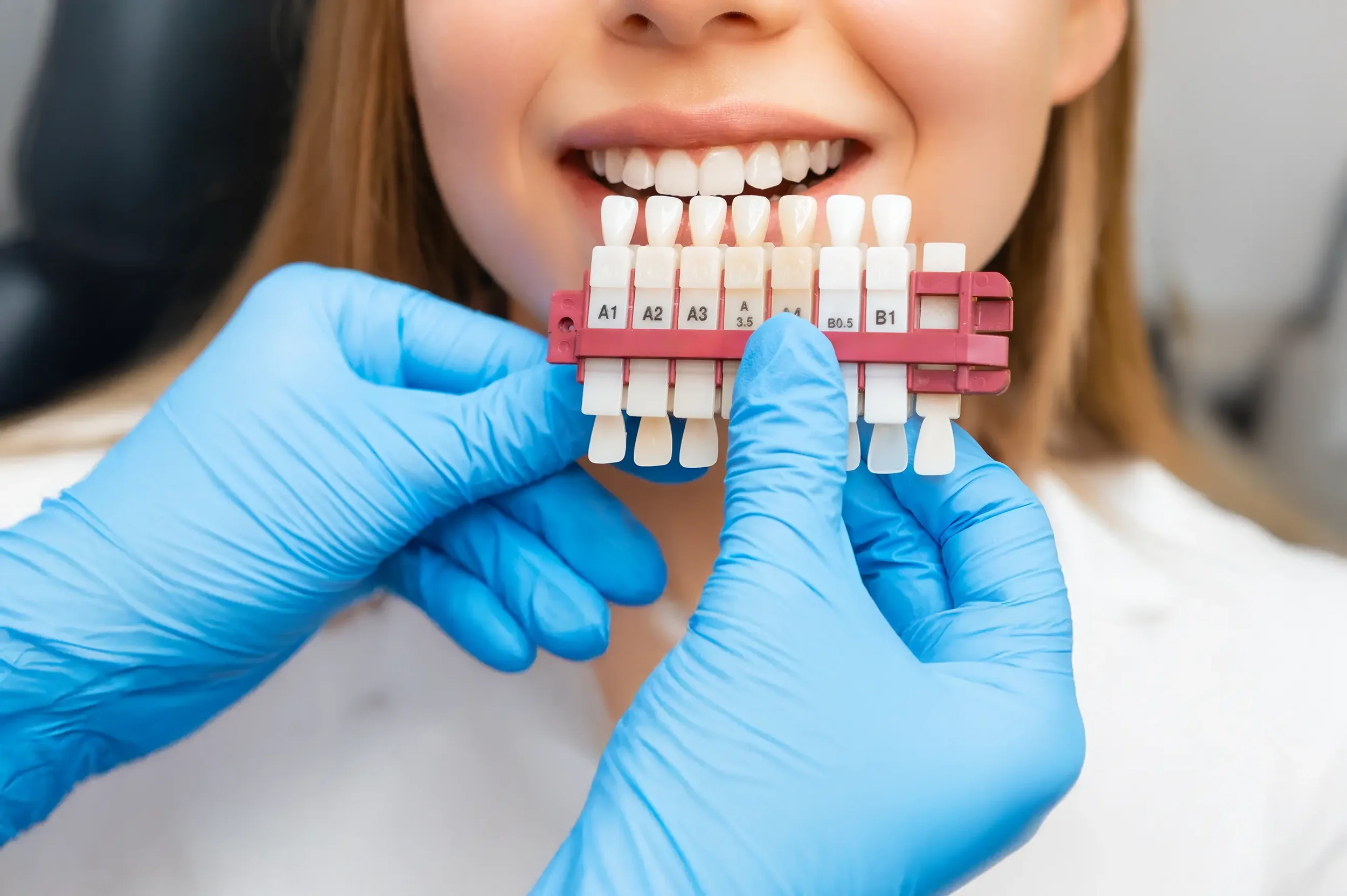 Close-up of a smiling woman with visible teeth, holding a dental shade guide with gloved hands in front of her mouth.