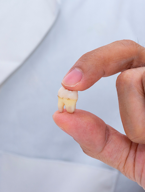 Close-up of a person's hand holding a small, broken tooth with visible roots.