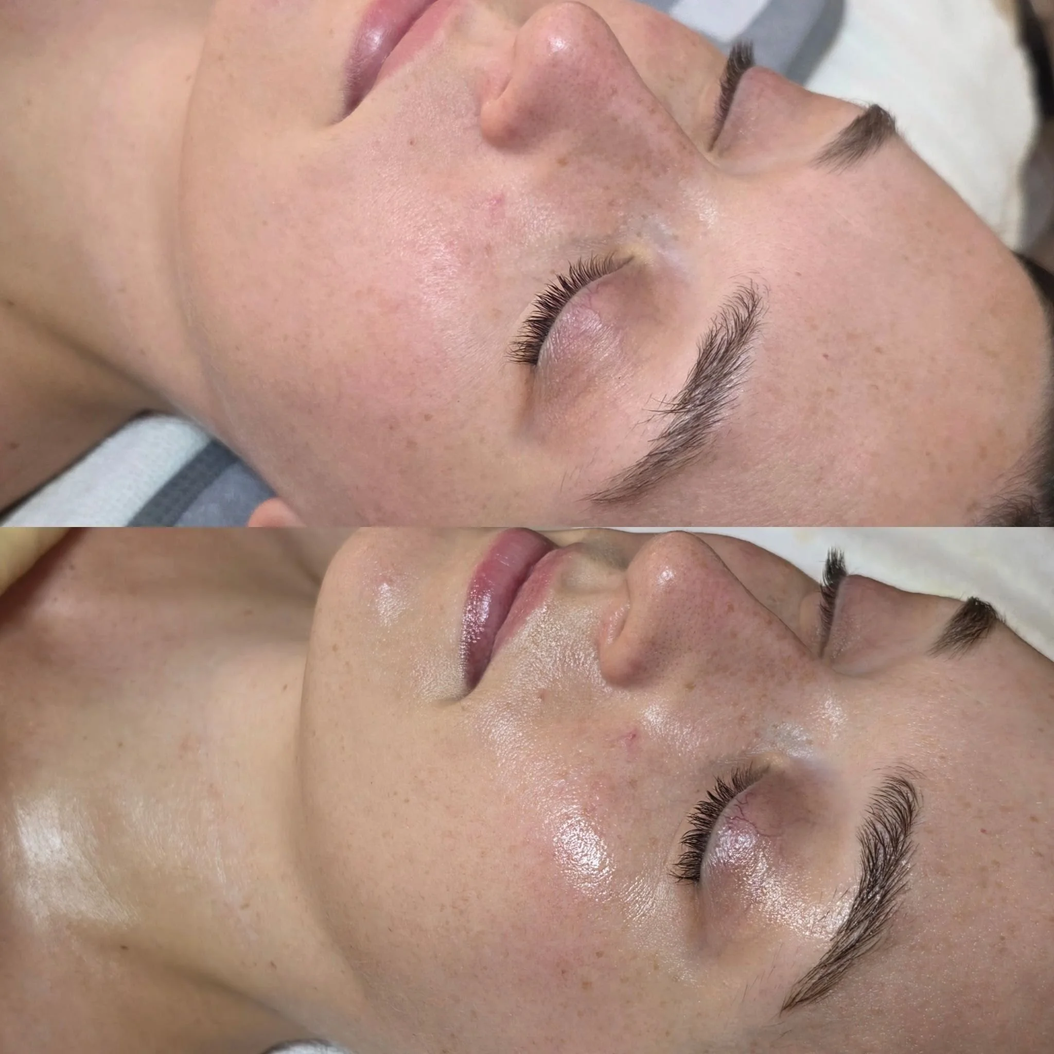 Before and After Customized Facial with Microcurrent