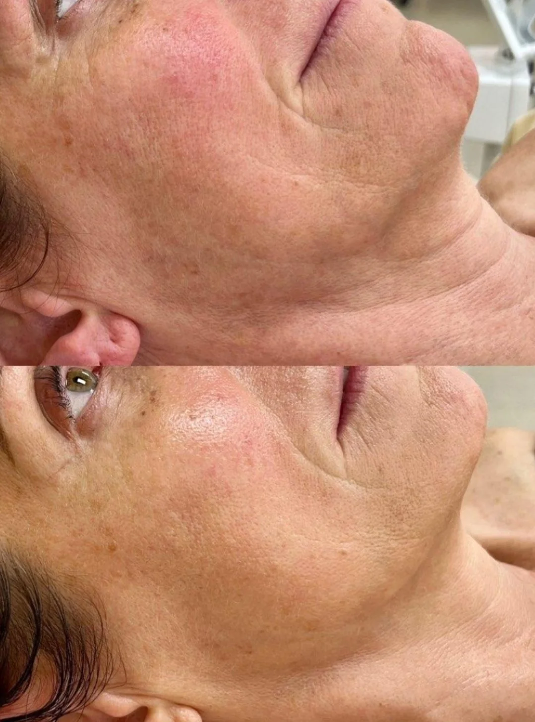 Emma's facial client had instantly toned and sculpted skin after one microcurrent session, which is non-invasive and a holistic approach to muscle toning and tightening at Dahlia Beauty Bar.