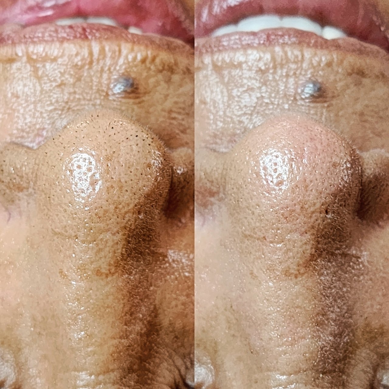 Before and After of extractions, which unclog pores, during a Dahlia Signature Facial at Dahlia Beauty Bar