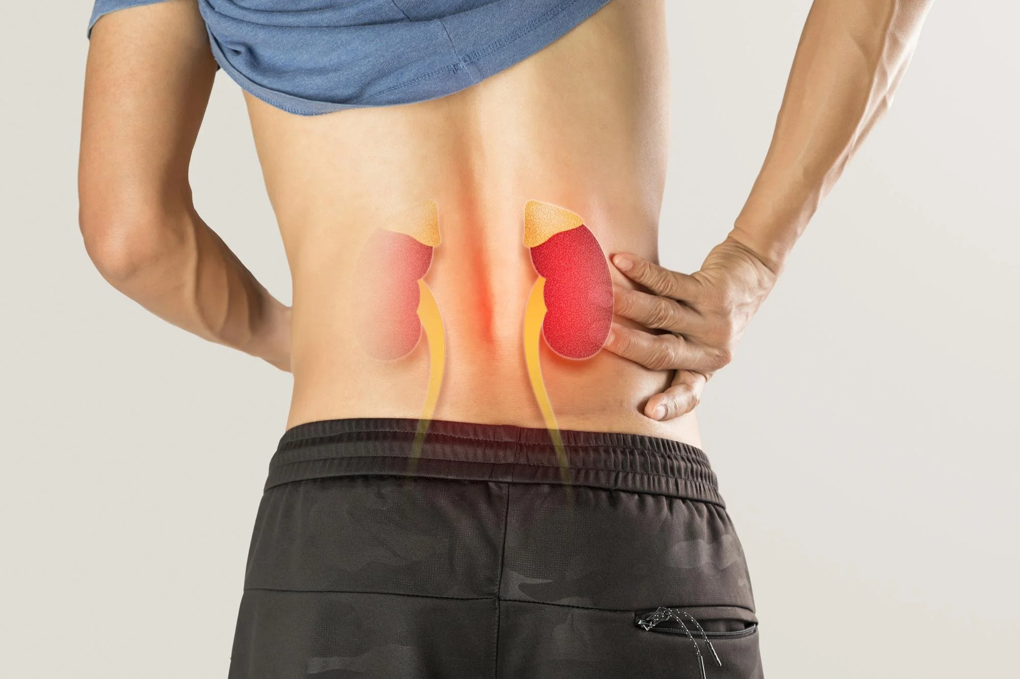 A person with one hand on their lower back, showing an illustration of red and yellow patches on their lower back representing pain or injury.
