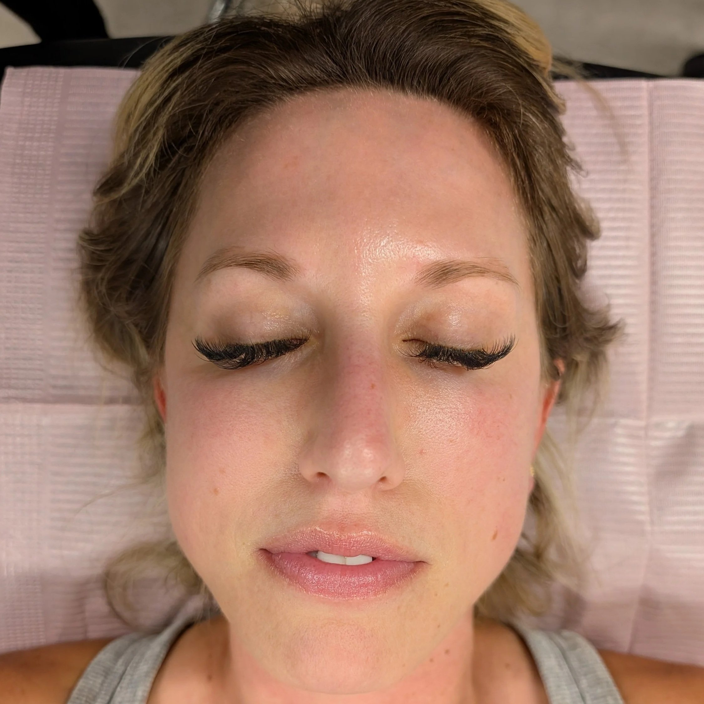 A close-up of a woman's face with her eyes closed, showing her forehead, eyebrows, and partially visible lips, lying on a pink textured surface. before microbladed brows