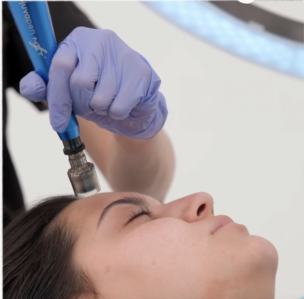 A person lying down with eyes closed receives a facial treatment using a small handheld device, with a gloved hand operating it.