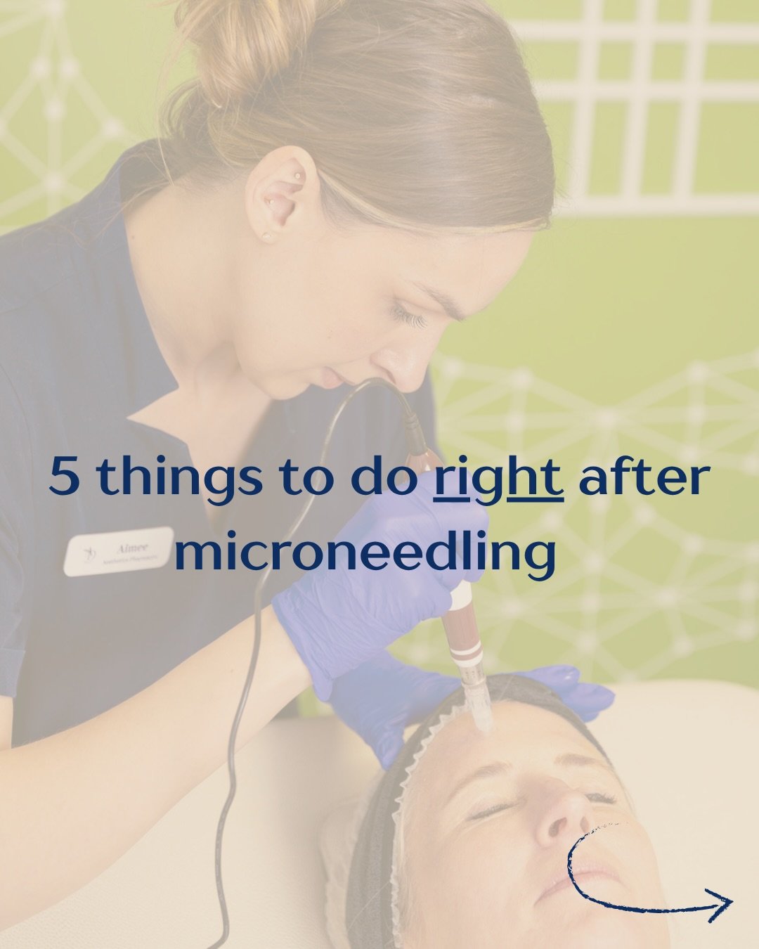 Just had your microneedling? We GOT YOU!

Here are 5 things you NEED to do after your treatment to keep your skin happy and get the best results! 
1️⃣ Avoid touching your skin
2️⃣ Wear a hat if going outside if unavoidable
3️⃣ Skip the gym
4️⃣ Keep t