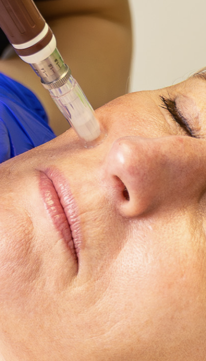 A woman receiving a facial treatment with a paraffin wax machine on her face.