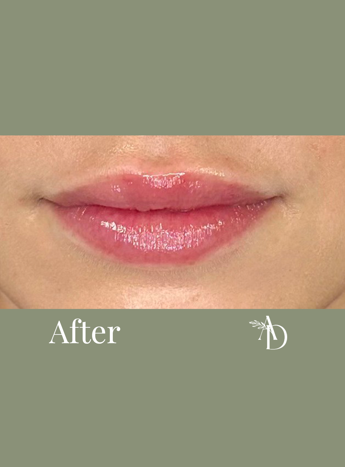Close-up of lips with glossy pink lipstick, showing a slight smile. The background is muted green with the words "After" and a logo on it.