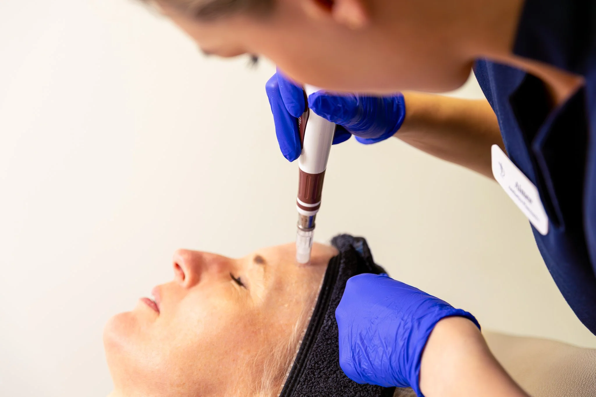 A healthcare professional wearing blue gloves performs a procedure on a patient's face with a pen-like tool.