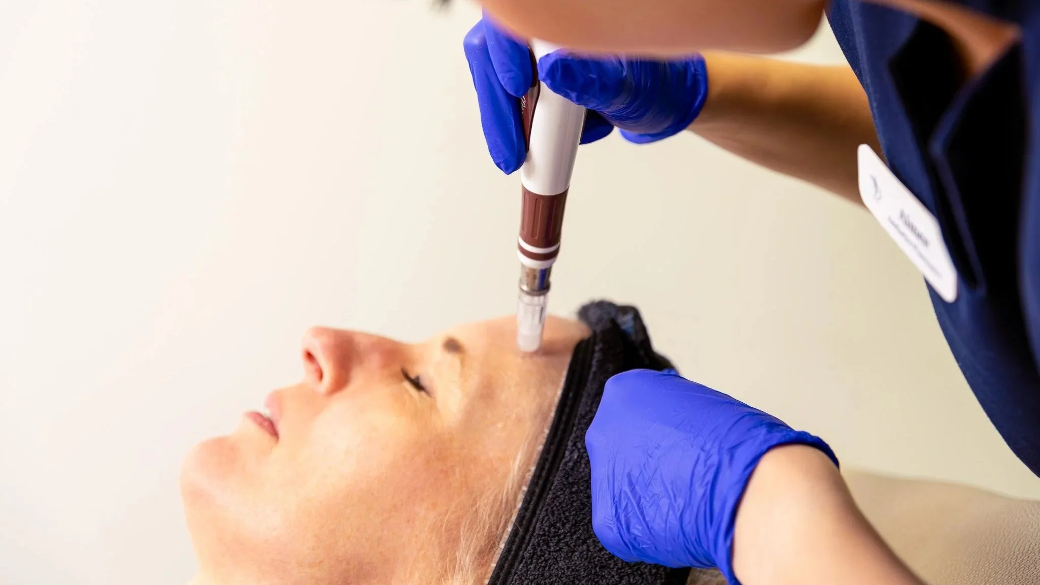 A person receiving a cosmetic injection in the face from a medical professional wearing blue gloves.